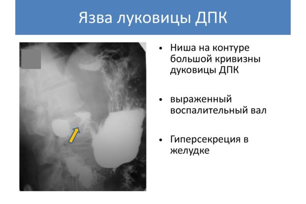 Кракен даркнет зайти